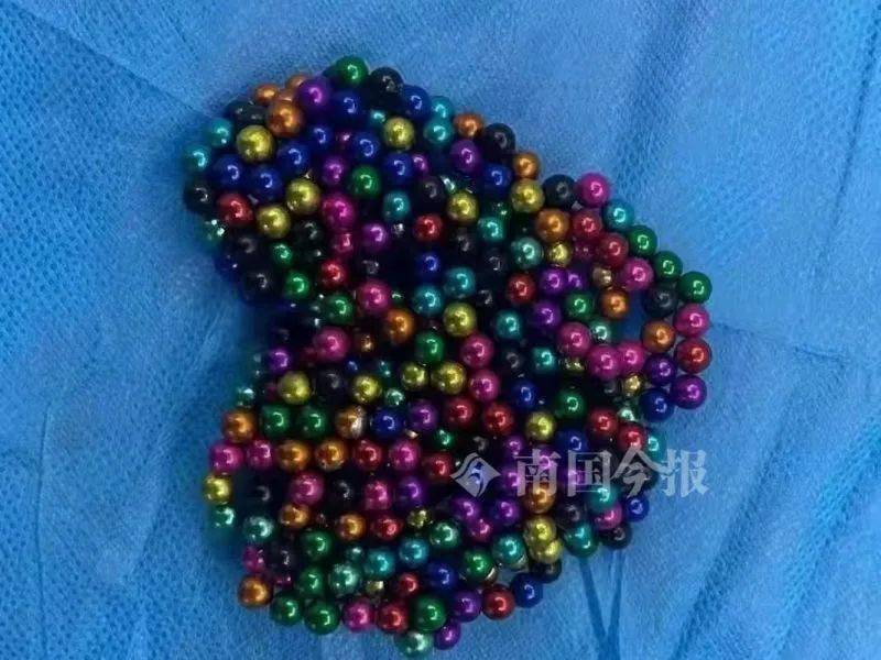 柳州4岁男童吞34颗钢珠 家长:去年的玩具 发现珠子越来越少