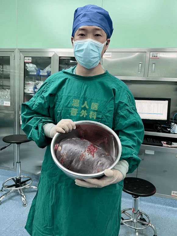 大妈腹内长10斤重巨脾,是常人的35倍!