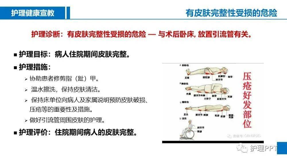 由脐周→右下腹→全腹 腰大肌试验 ( )(后位阑尾) 闭孔内肌试验 ( )