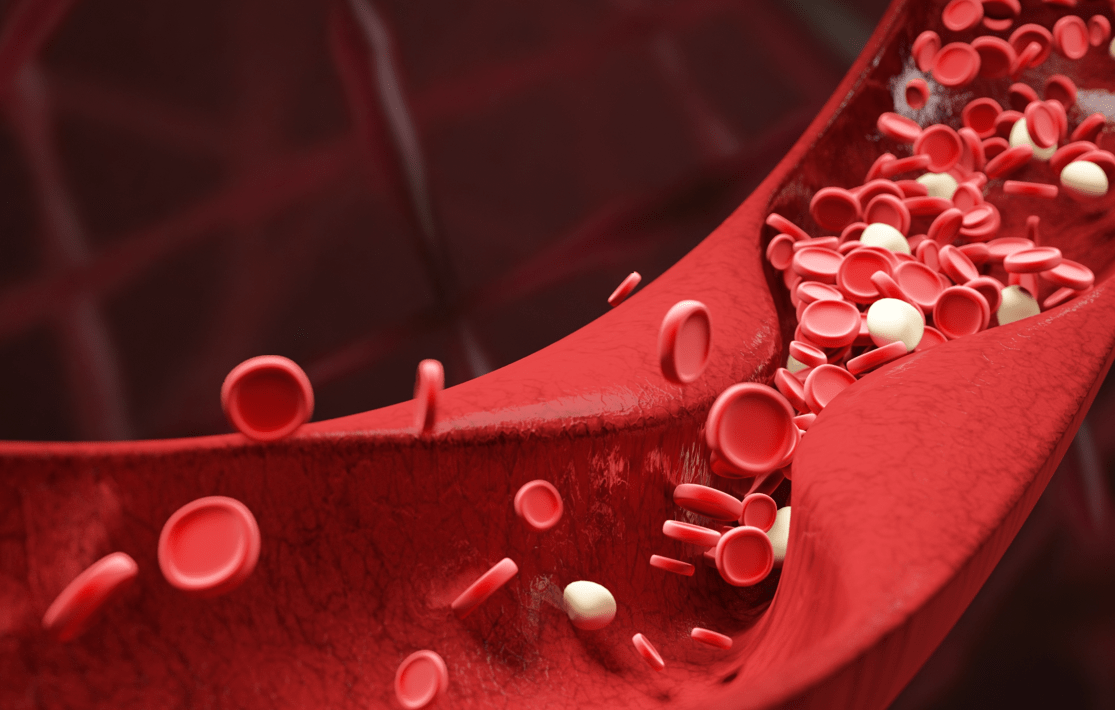 流通|吃火锅会引起心脏病？