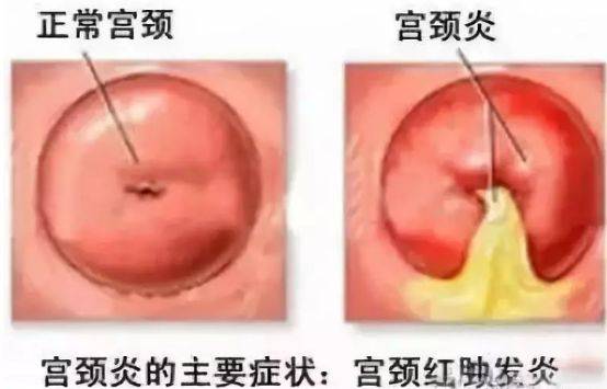 带你全面认识女性的生殖系统《如何保持女性生殖健康》(女性必读)