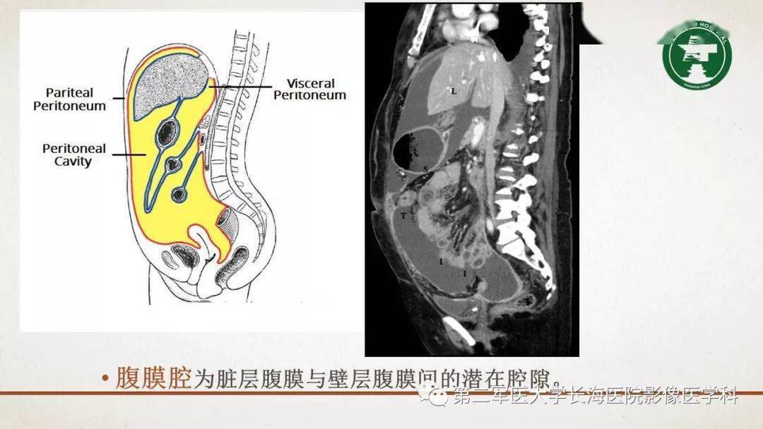 包罗万象的腹膜结构我们真的了解吗影像解剖