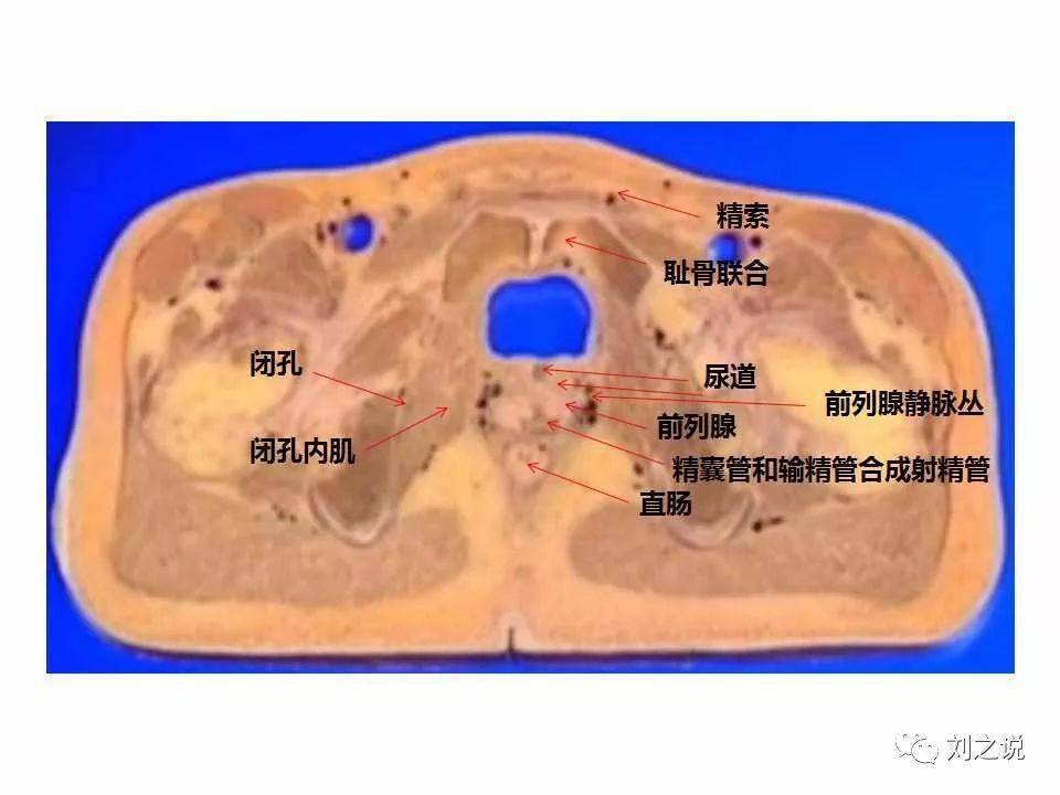 收藏必备男性盆腔断层解剖