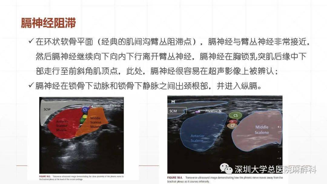 术中呃逆及顽固性呃逆( 深圳大学总医院麻醉科)_孙玲