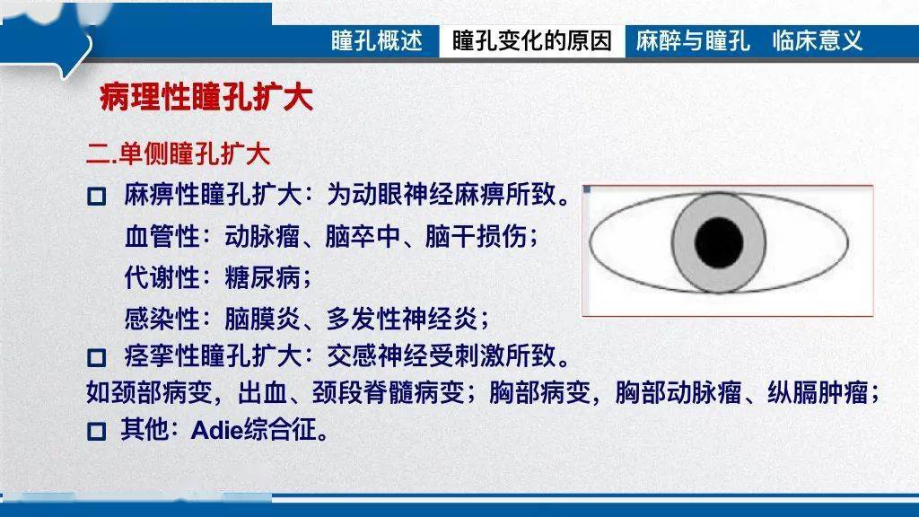 病例报告让人虚惊一场的瞳孔散大围术期瞳孔变化及临床意义