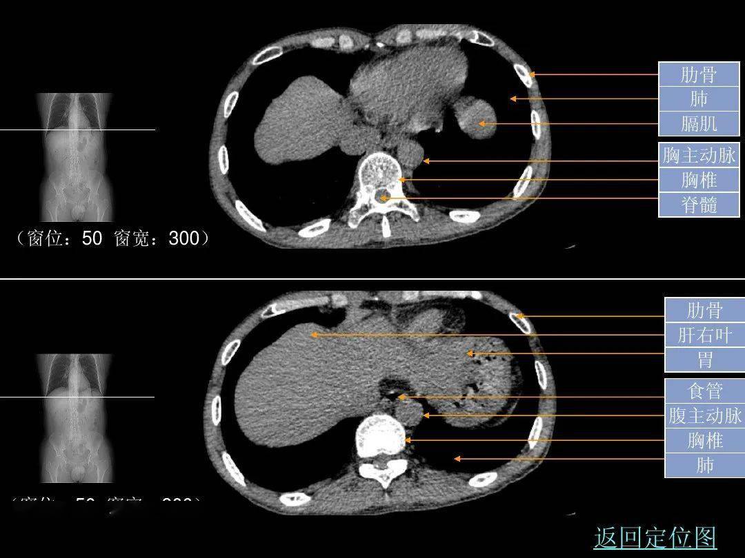超细的腹部ct入门精美解剖图谱_图像_血管_器官