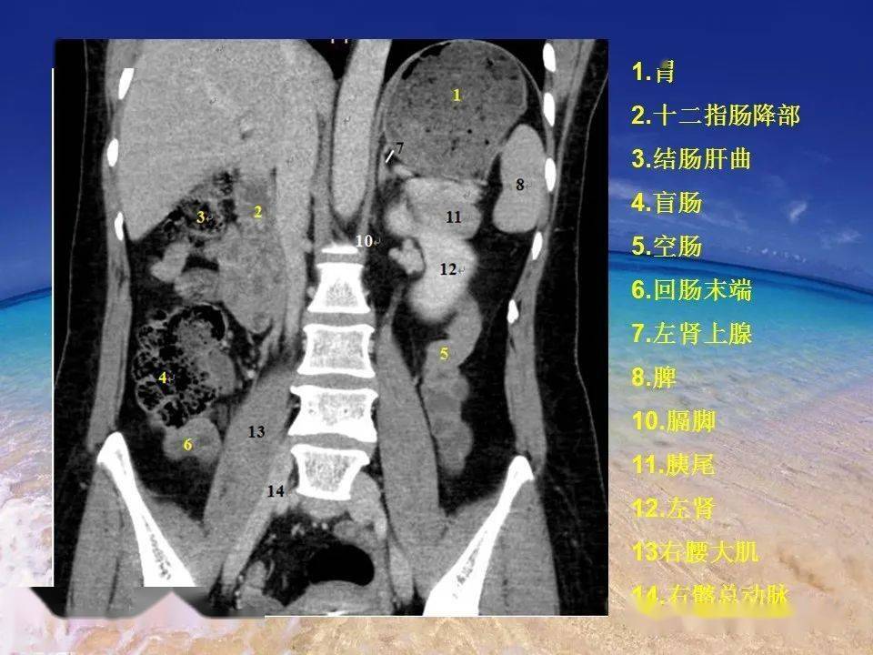 消化道穿孔ct影像大汇总看完印象深刻