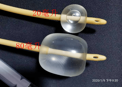 水囊,使子宫腔膨胀,引起垂体后叶催产素释放增加,达到引产宫缩所需的