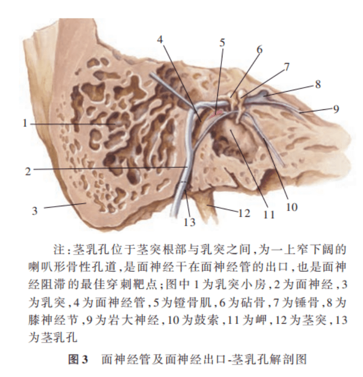 而茎乳孔有明确的骨性解剖标志,且此处面神经干的位置相对固定,因而是