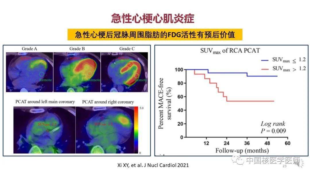 【核汇园】67期:杨敏福教授 fdg心血管显像的拓