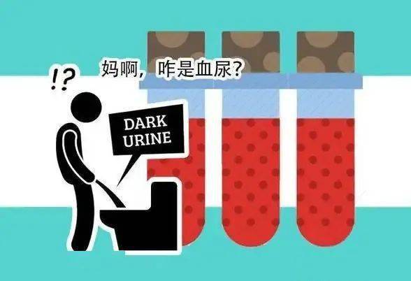 血尿你想到这个病了吗？