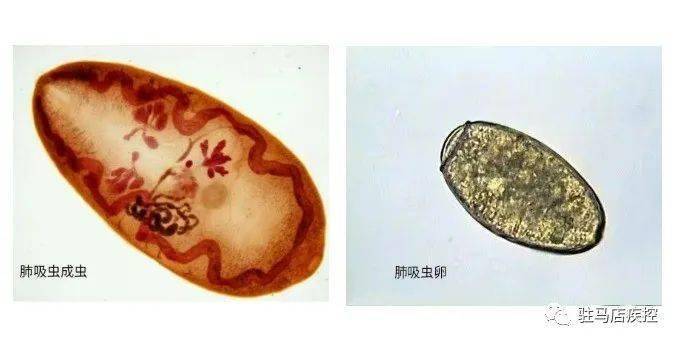 结果染上这种病_肺吸虫_寄生_肺部