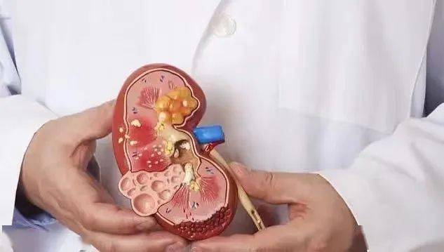 【华康科普】尿素氮与血肌酐比值的具体意义？
