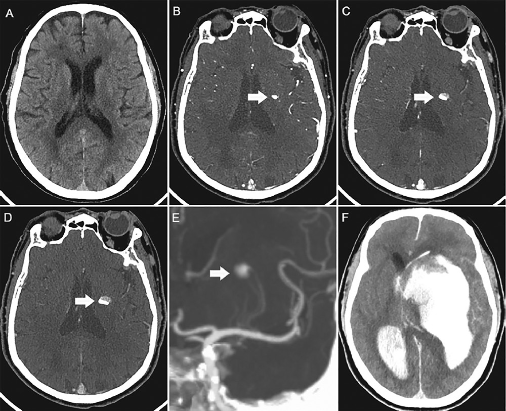 Χۣ2022ȶRadiologyѡ𺳵 ...