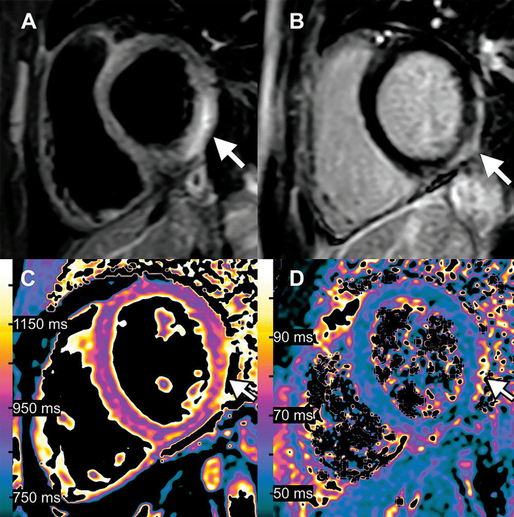 Χۣ2022ȶRadiologyѡ𺳵 ...