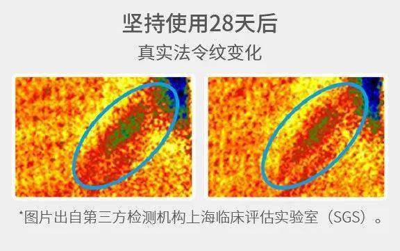 口碑炸裂！女明星同款ReFa美容仪2折捡漏，28天淡纹紧致更年轻