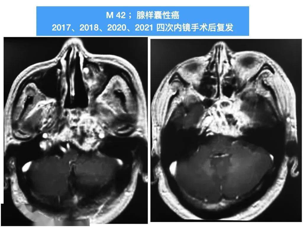 【2022年】佟小光＆Miranda年度手术TOP10