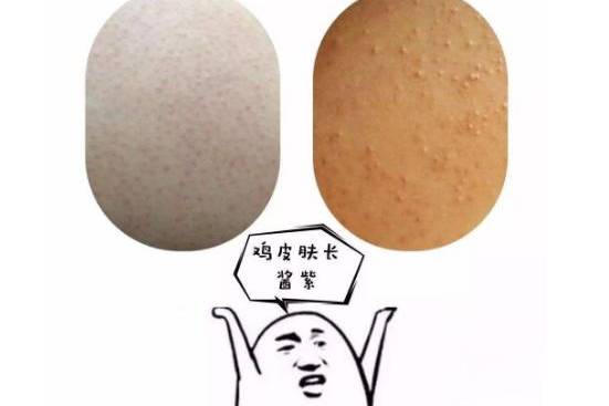 鸡皮肤平时该注意些什么(鸡皮肤平时该注意些什么呢)