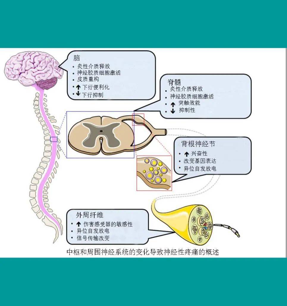 拿什么拯救你的神经痛