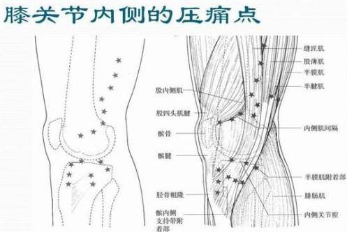 18个痛点的准确位置图-尚鑫金服