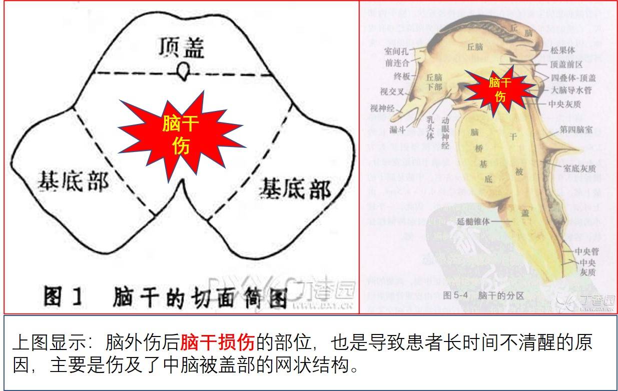 纖維束眾多,其中管理我們覺醒的