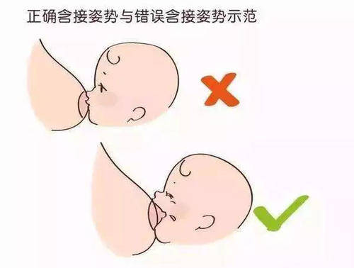 正确的衔乳姿势应是宝宝含住妈妈的乳头和大部分乳晕,而不是只含住