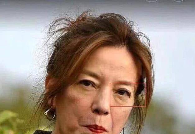 那些打除皱针的女人后来都变成什么样了当事人真的后悔