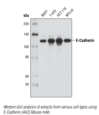 ecadherinncadherin谁是肿瘤侵袭的主角