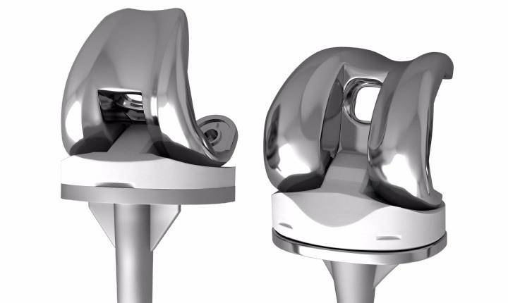 老年人可以做人工关节置换吗?