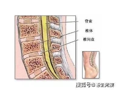 的症狀,表現為病變水平,以下同側肢體肌張力增加,肌力減弱,腱反射亢進