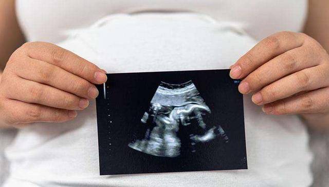 原创一个月的胎儿是什么样?刚怀孕的女性来了解一下,有四件事要注意