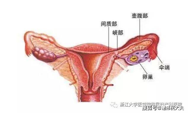 输卵管造影延迟片图解图片