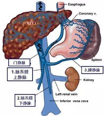 一方面是因为肝硬化的病人产生了门脉高压症,大量血液从食管胃底静脉