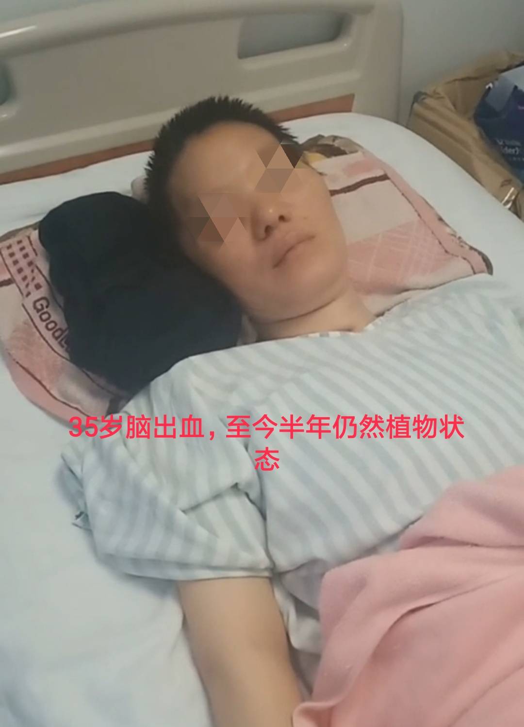 35岁脑出血植物人,何以如此年轻就得了脑出血?青年高血压的注意事项