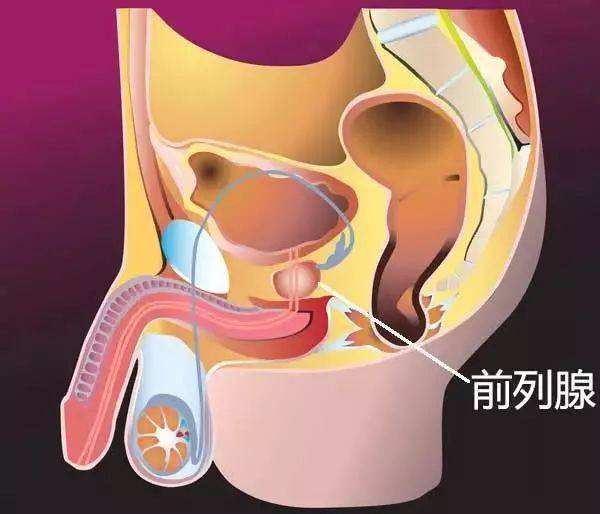 引起前列腺炎的病因有哪些前列腺炎如何调理