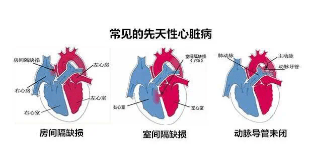 關於胎兒心臟彩超這些你要了解!