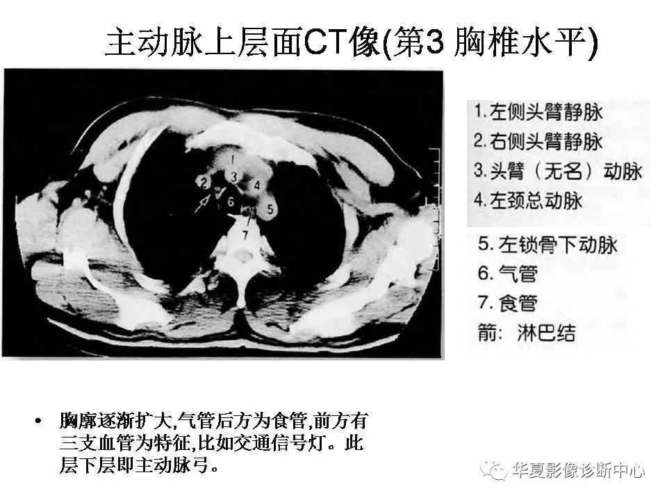 e32d5a8886684a40950d083dbca67e25.png