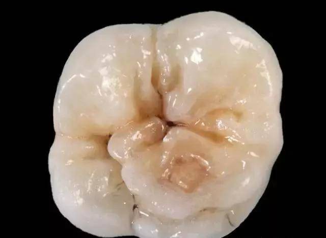 临床技能根管治疗标准七步曲