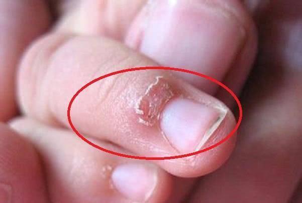 医生一般都不外说,家长赶紧看_孩子