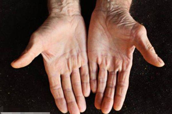 原创心理测试:4个老人的手掌,哪一个最苍老无力?测你晚年是什么命