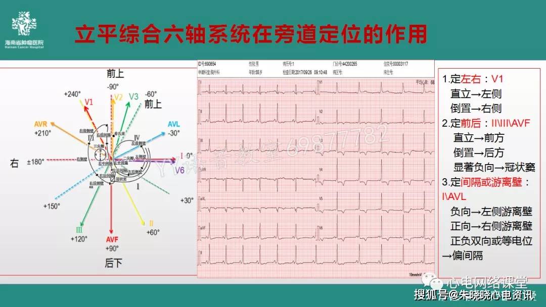 六轴系统在心电图学习中的运用