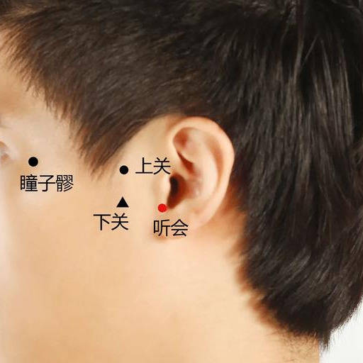 三穴合灸,直接作用于穴位,对穴位形成强烈的刺激,加强疏通耳部气血.