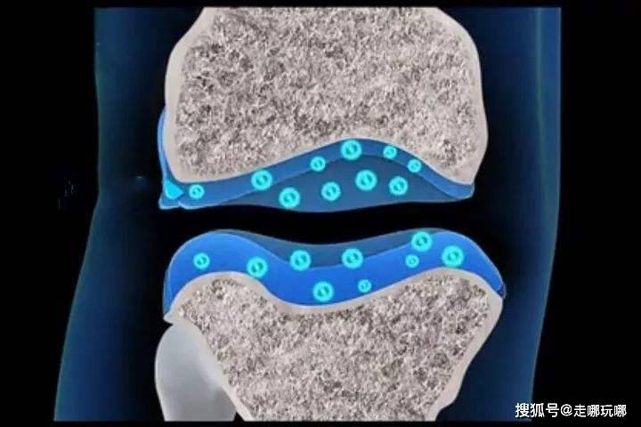 【晟唐孵化器】骨关节炎患者福音,科学家利用骨骼干细胞成功再生关节