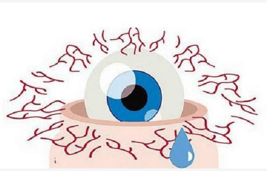 建议|一个小方法，自测干眼症（建议收藏）