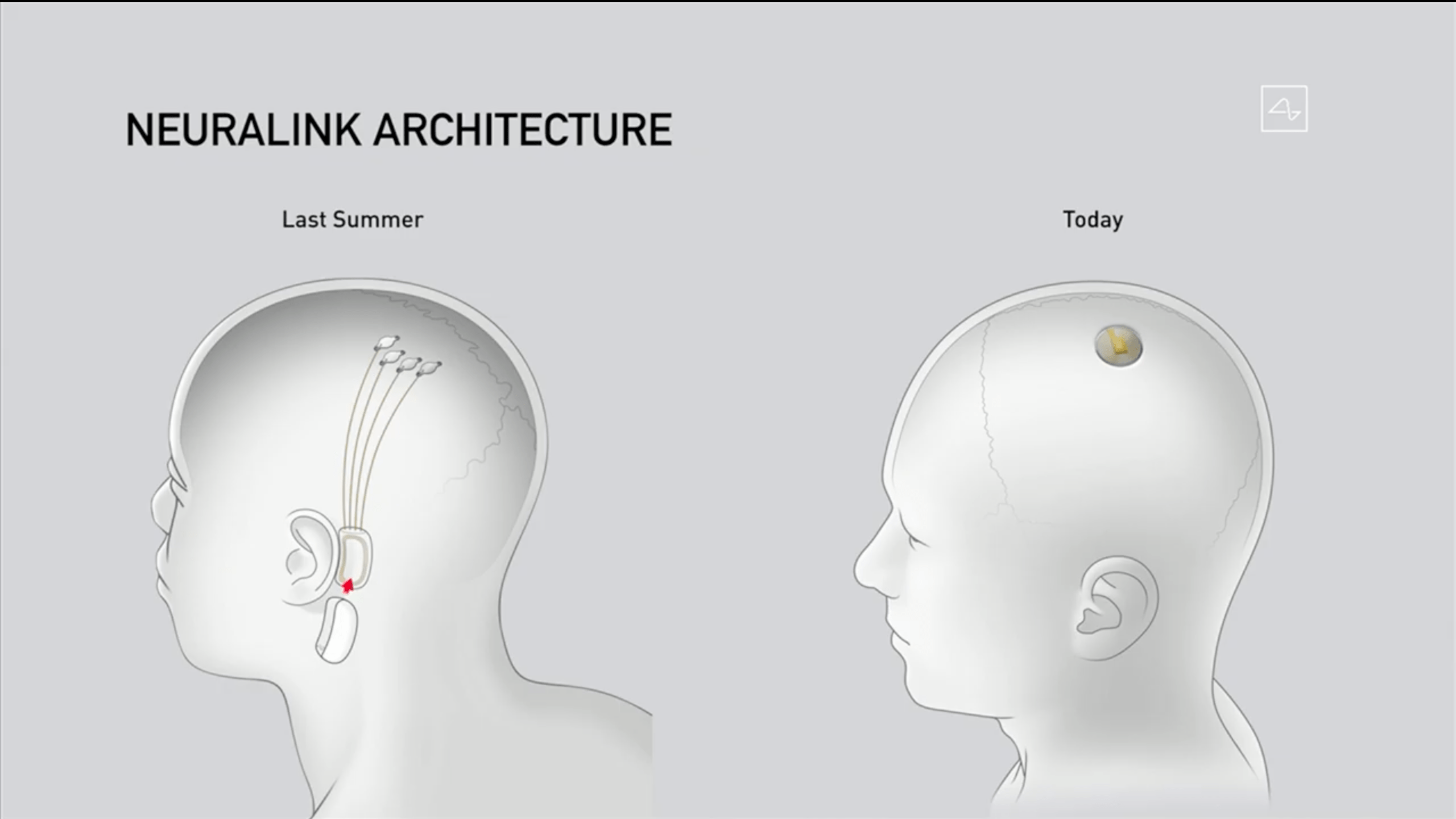 neuralink设备与2019年展示的脑机接口设备不同的是,最新一代的neural