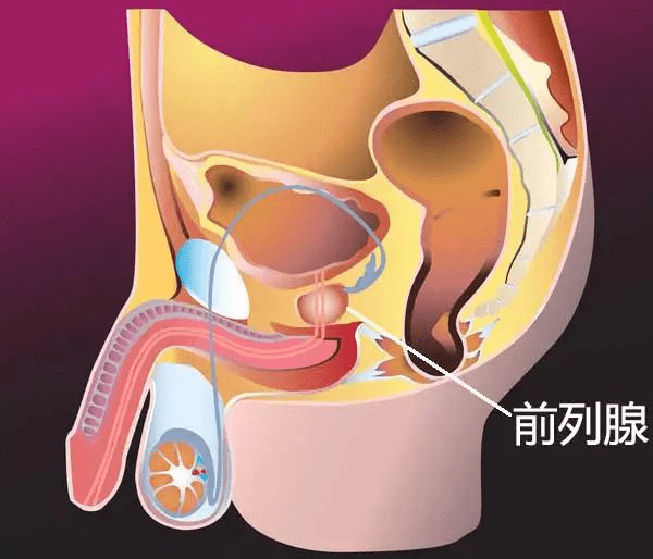 年纪一大,男性前列腺就容易出故障,但是很多中年男性对此讳莫如深