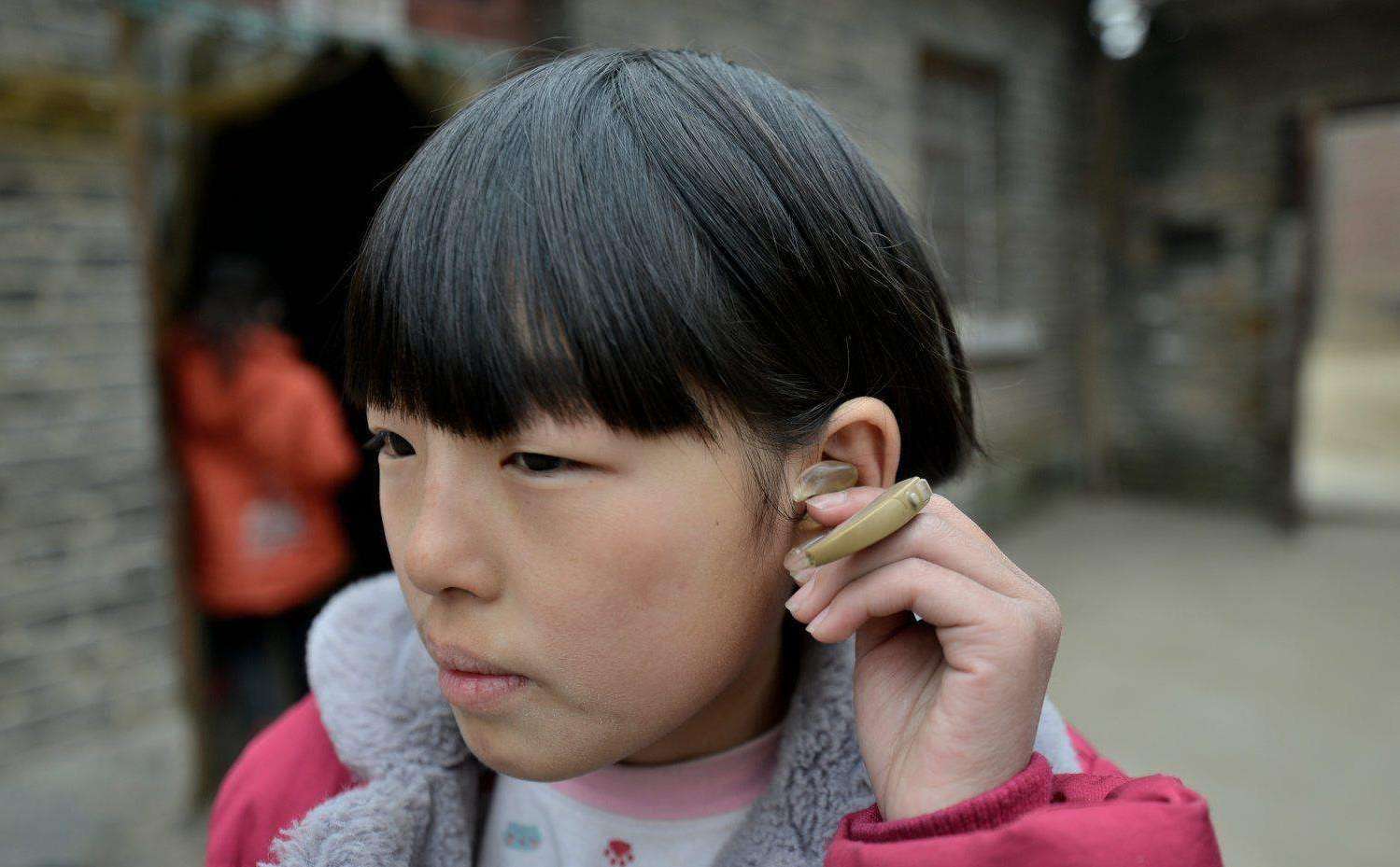 14岁以下儿童每年用药致耳聋达3万人药物禁忌家长需谨记