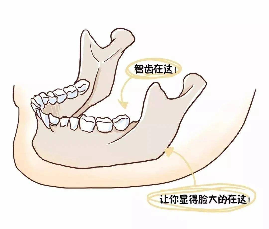 智齒可以一次拔四顆嗎