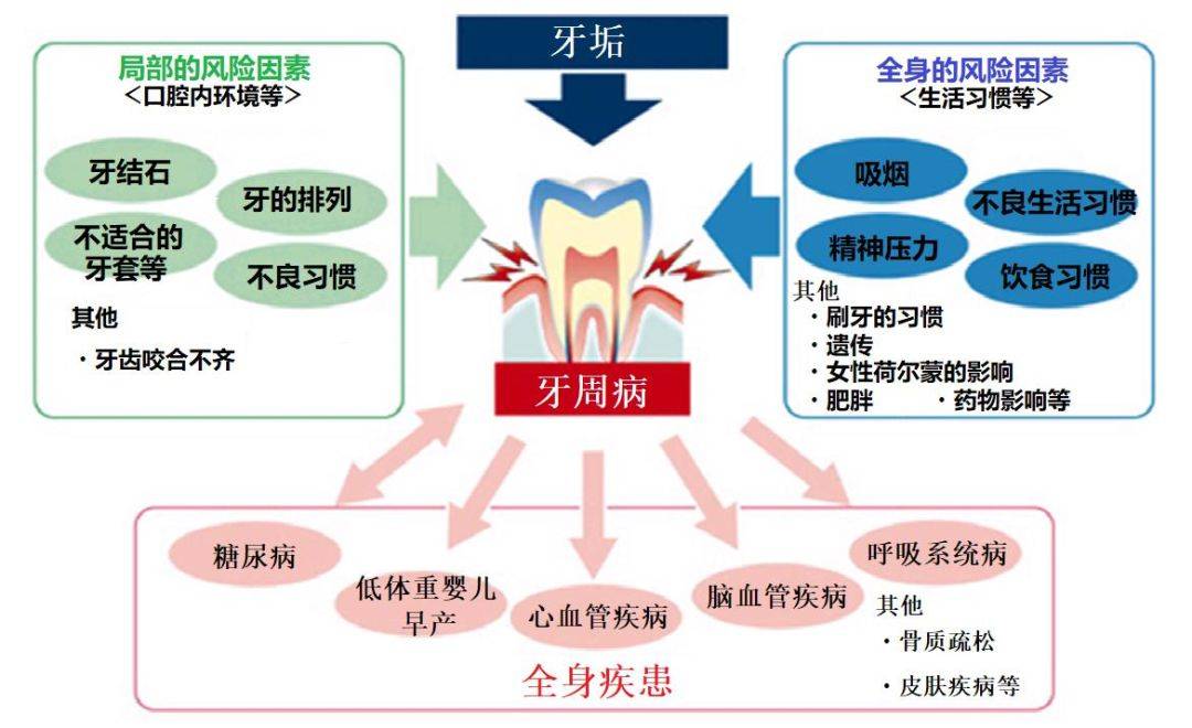 日本干细胞应用临床间充质干细胞与牙周病的再生治疗