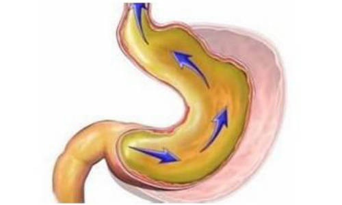 胆汁反流示意图